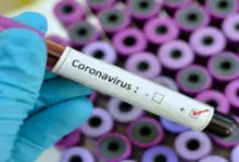 Photo of Coronavirus Affected World: Needs Courageous and Strong Leadership