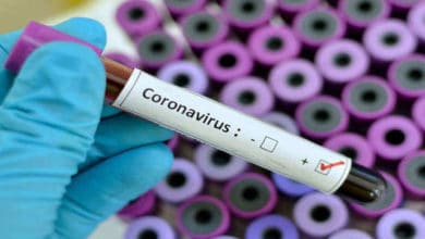 Photo of Coronavirus Affected World: Needs Courageous and Strong Leadership