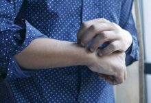 Photo of মানসিক সমস্যার কারণে চুলকানি হলে কী করবেন